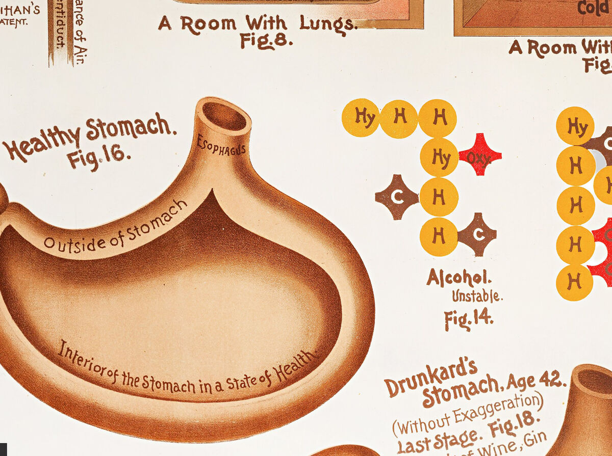 Vintage Sanitation and Hygiene promotion poster chart, science anatomy, human lungs and alcohol effects | Clinic Decor Wall Art - product images  of 