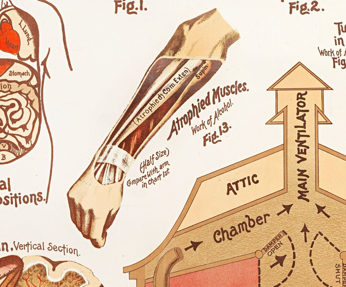 Vintage Sanitation and Hygiene promotion poster chart, science anatomy, human lungs and alcohol effects | Clinic Decor Wall Art - product images  of 