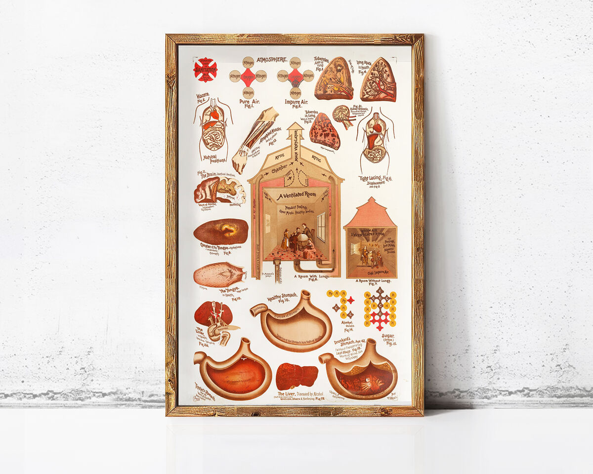 Vintage Sanitation and Hygiene promotion poster chart, science anatomy, human lungs and alcohol effects | Clinic Decor Wall Art - product images  of 