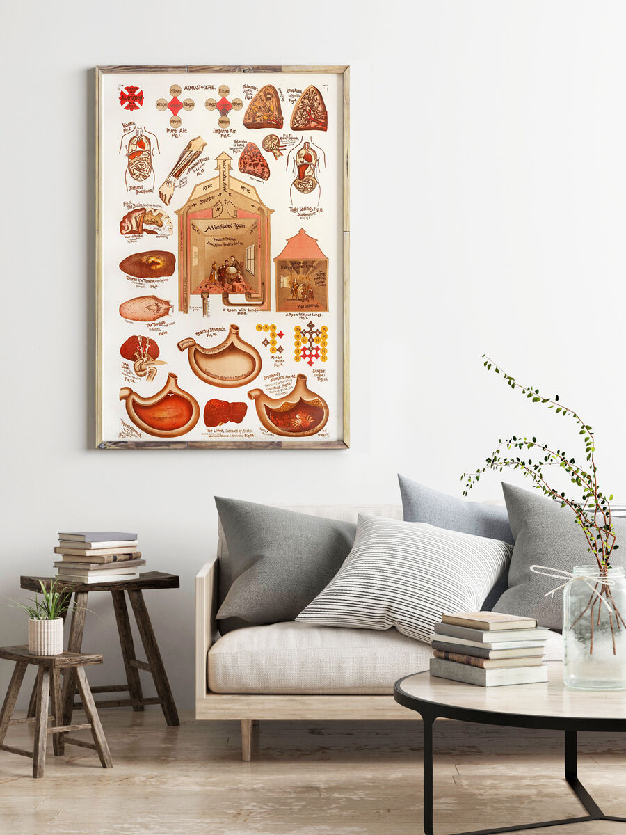Vintage Sanitation and Hygiene promotion poster chart, science anatomy, human lungs and alcohol effects | Clinic Decor Wall Art - product images  of 