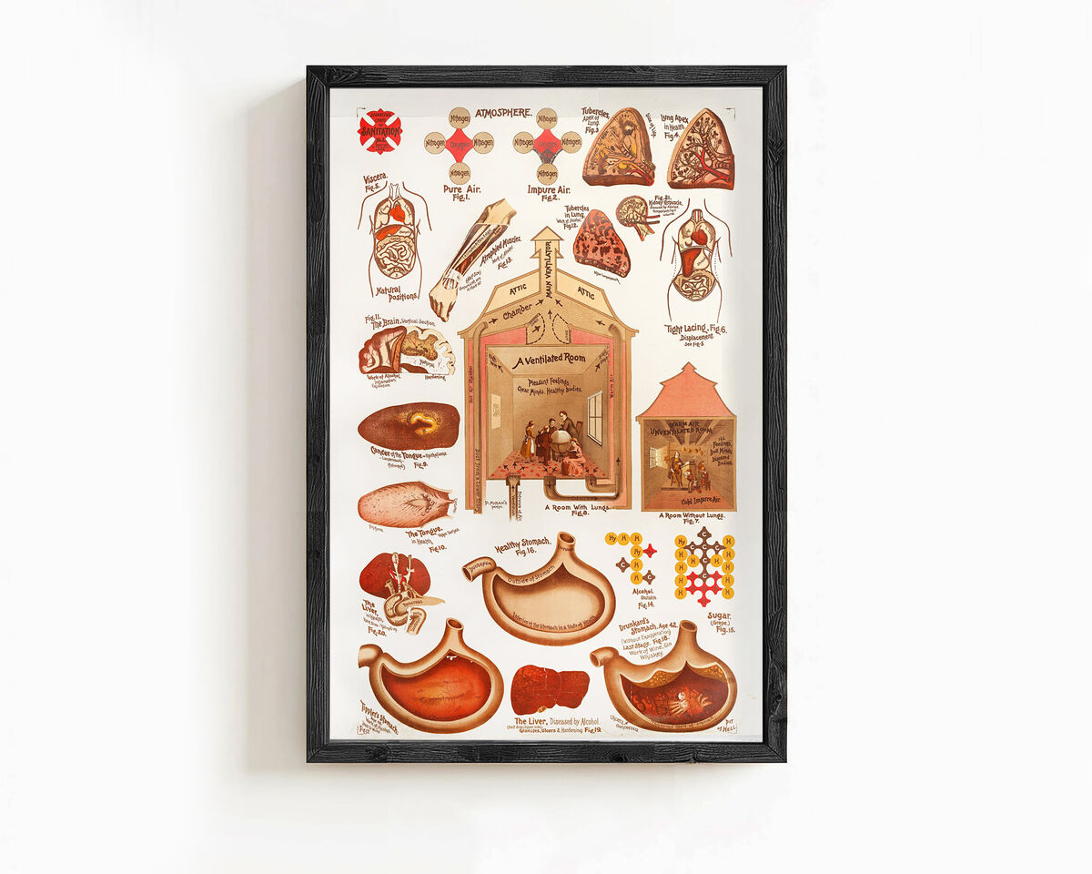 Vintage Sanitation and Hygiene promotion poster chart, science anatomy, human lungs and alcohol effects | Clinic Decor Wall Art - product images  of 