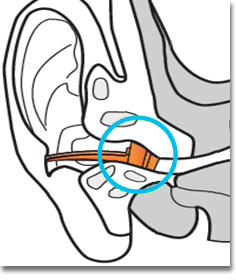 SORKY surf earplugs - product images  of 